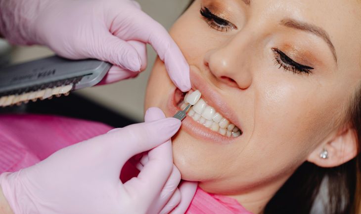 Kako brzo do savršenog osmeha pre važnog putovanja